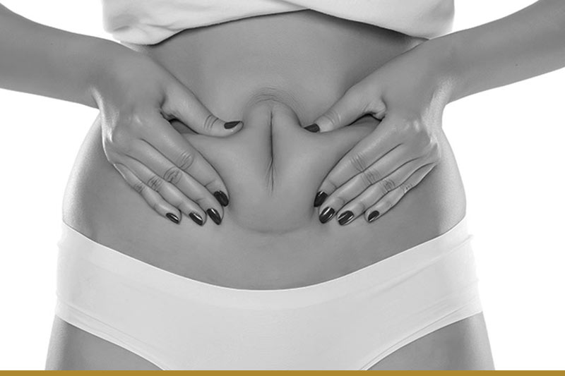 How to get rid of hormonal belly fat.