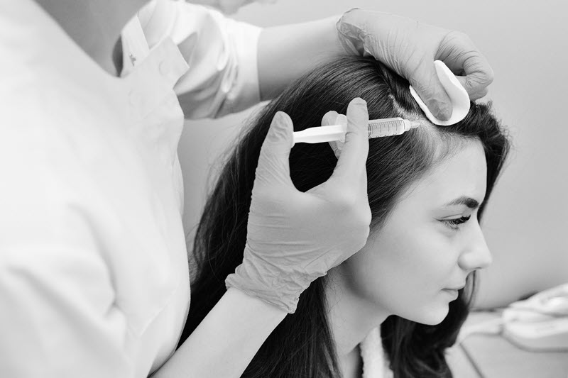 PRP treatment for hair loss